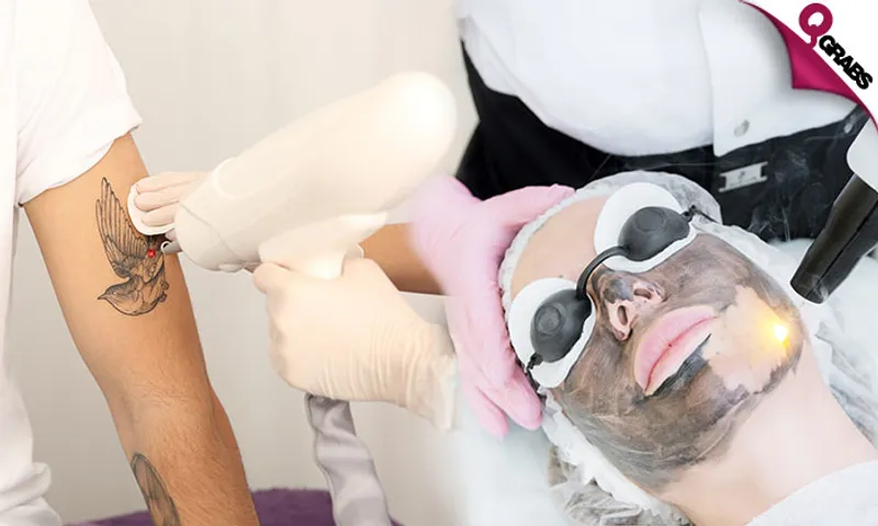 Q-Switch Laser: Carbon Peel, Lip Lightening, Eyebrow Bleaching & More!